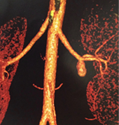 Arteriografias e Flebografias